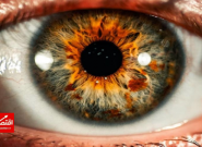 طراحی یک برنامه برای تشخیص خشکی چشم