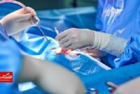 جراحی کاشت الکترود در مغز دختر ۱۲ ساله